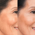 Side-by-side comparison of cheek area before and after Ageless Bloom Anti Aging use, showing smoother, youthful skin.
