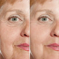 Close-up before and after of eye area showing reduced wrinkles and fine lines after using Ageless Bloom Anti Aging cream.